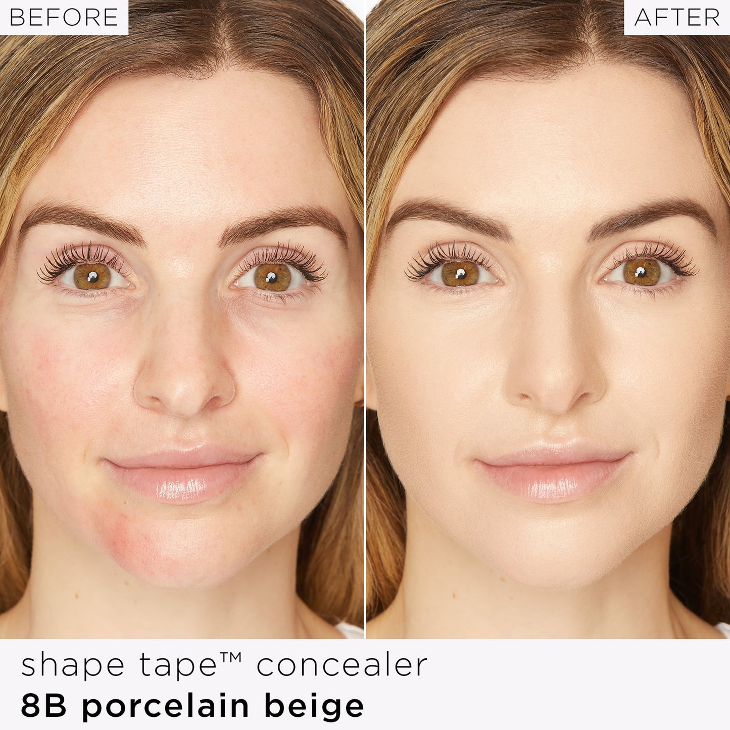 Shape Tape™ - Anticernes